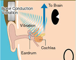 Hearing through bone vibration